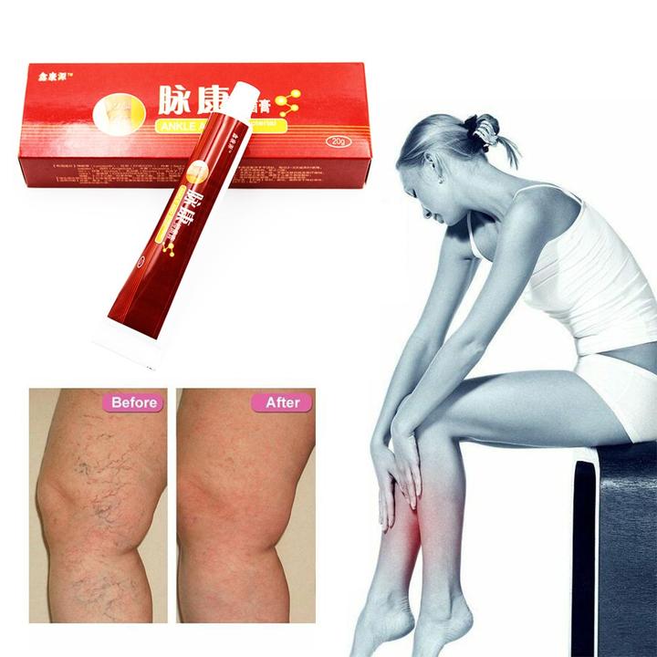 20g-Varicose-Veins-Removal-Varicose-Veins-Treatment-Cream-Ointment-Vasculitis-Inflammation-Chinese-Herbal-Leg-Massage-Plaster_720x